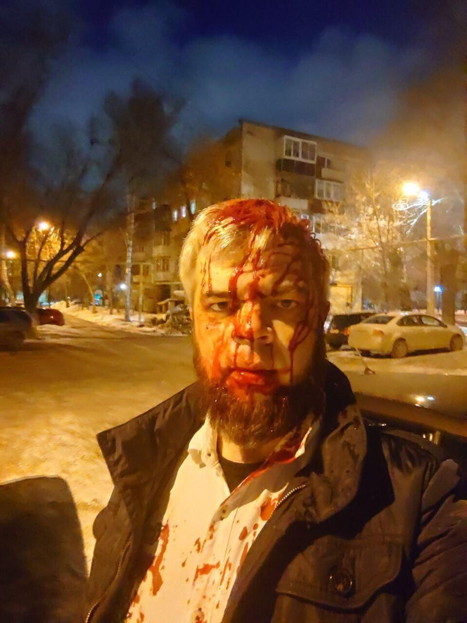 Николай Кофман после нападения на него. Фото: телеграм-канал Валентины Волковой